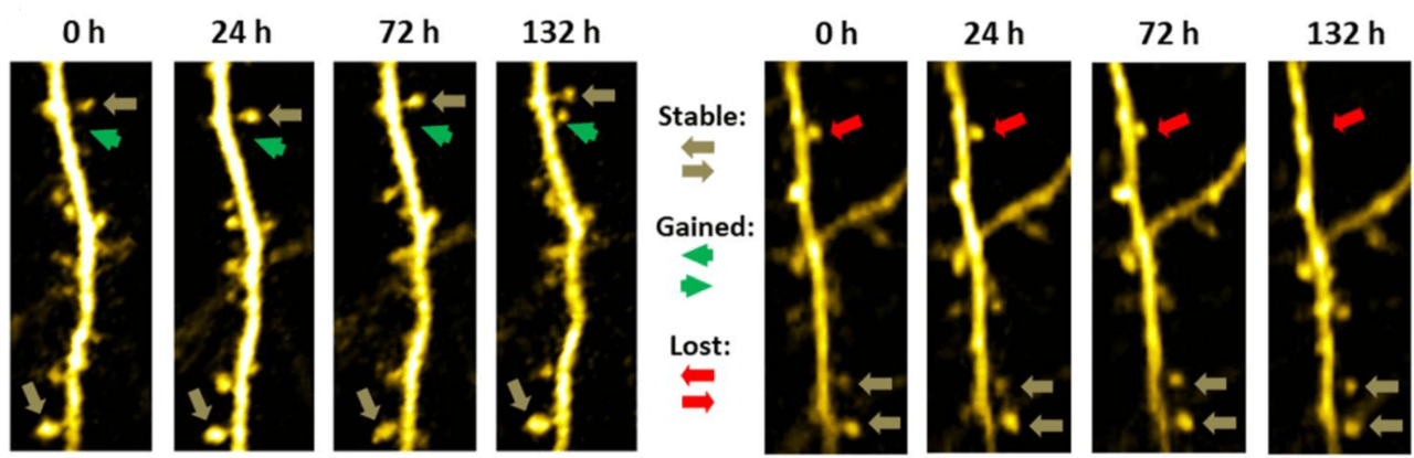 Typical readouts of dendritic spine turnover assay performed by Neurotar