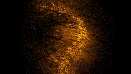 Calcium imaging in the hippocampus of awake mouse