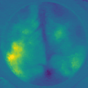 Wide-field imaging in awake mice